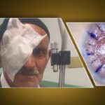 Transplantasyon ile birlikte verilen ışık … 83 yıl boyunca hasta 10 yıl boyunca kornea nakli bekliyor: “Gözlerimi açtınız”
