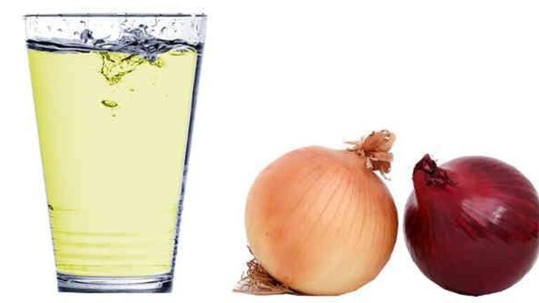 Soğan suyu cildi süslüyor: soğan suyunun faydaları nelerdir? Soğan suyu nasıl kullanılır, ne için?
